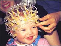 Se les coloc a los bebs una red de sensores en la cabeza.